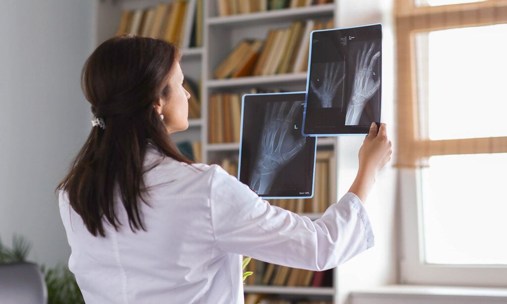 dottoressa che osserva lastre radiografiche di una mano