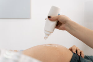 ginecologa che applica gel su donna incinta per ecografia